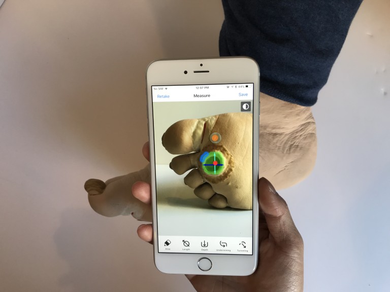 Swift Medical Technology to Power Healogics Photo Measurement  for Chronic Wounds