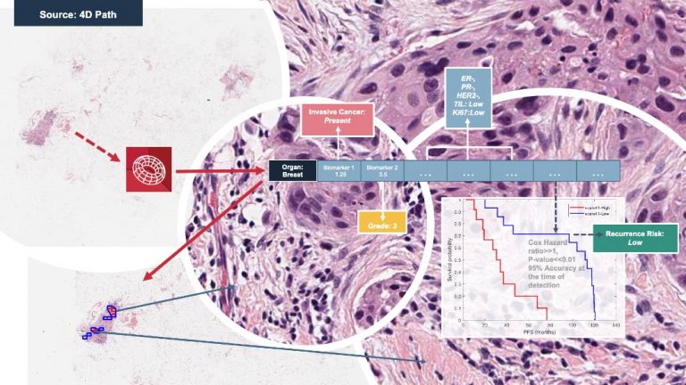 4D Q-plasia OncoReader Breast sample workflow and output.